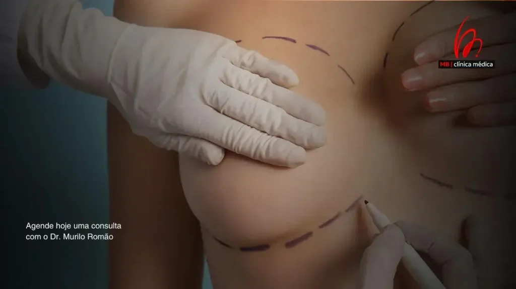 Excelência e Segurança nas Cirurgias Mamárias